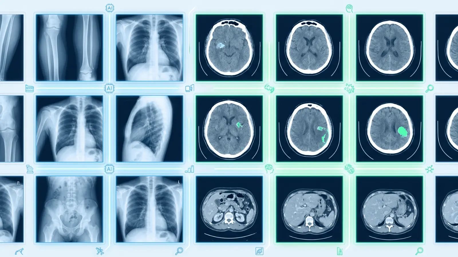 Grid of X-ray and CT scan images arranged in a digital system for automated analysis