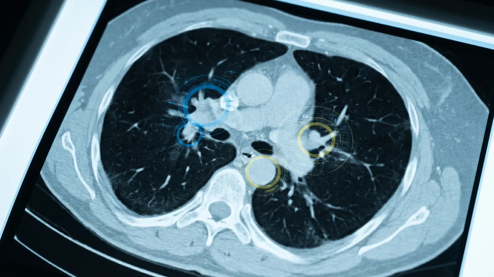 Medical scan with highlighted areas marking potential abnormalities detected by AI